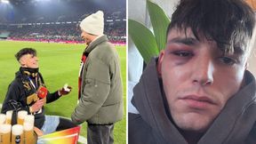 Oświadczył się partnerowi i został pobity. Są nowe doniesienia