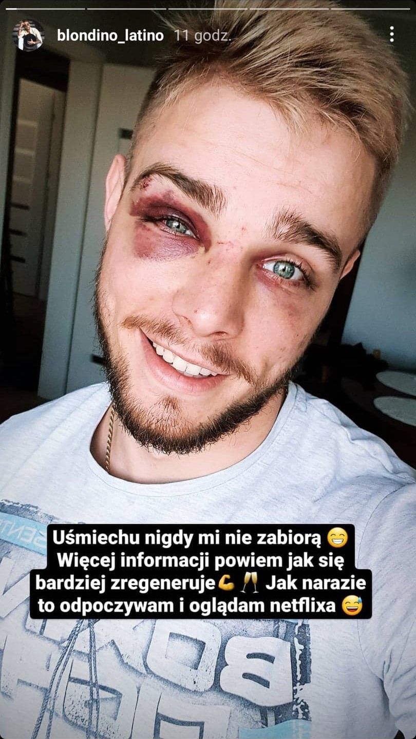 Blondino z "Hotelu Paradise" został pobity i okradziony