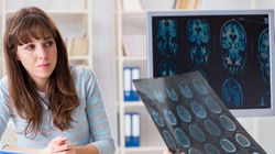 Lobotomia (leukotomia, lobotomia przedczołowa) - czym jest? Skutki, historia lobotomii