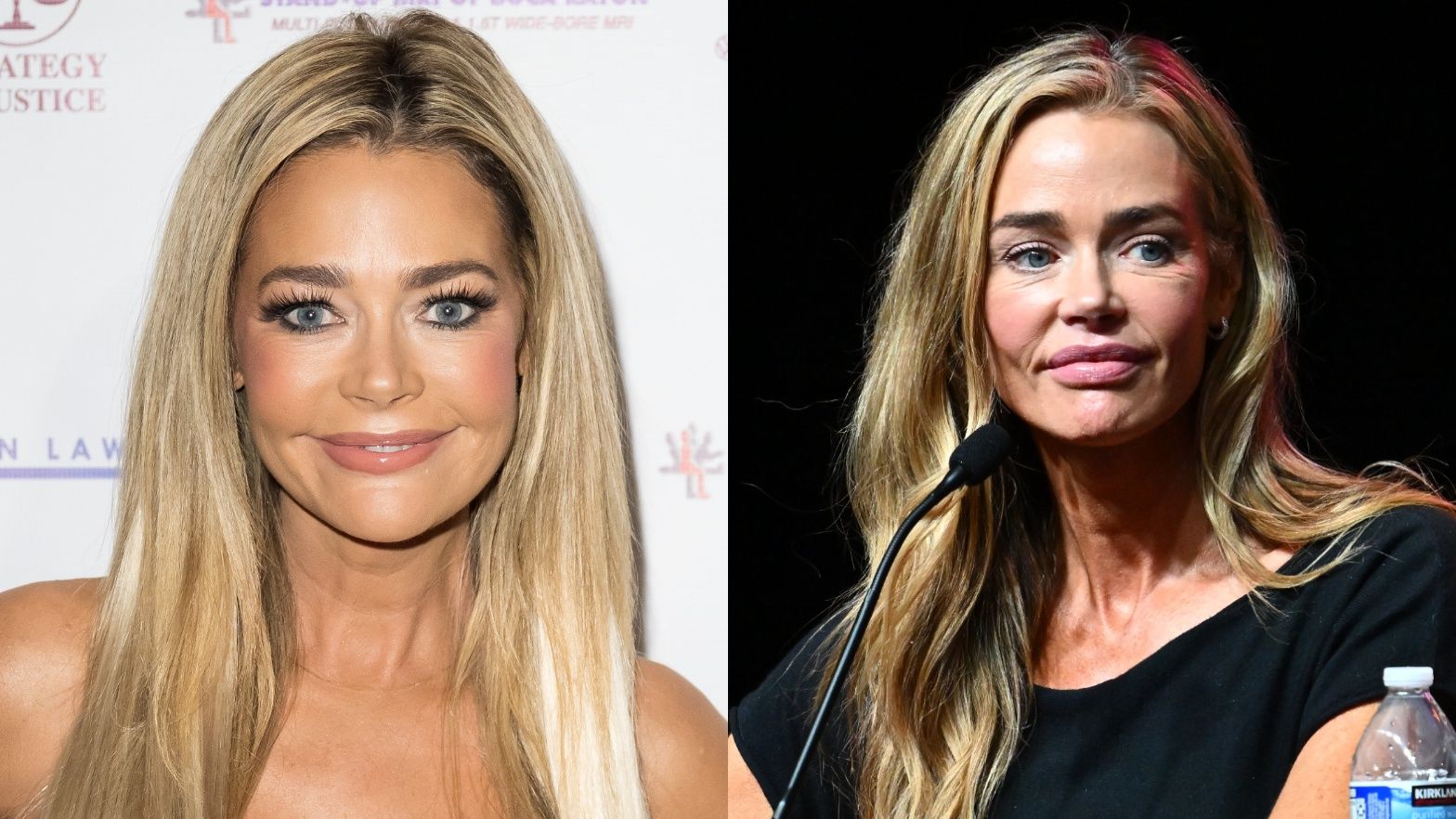 Denise Richards przed i po liftingu