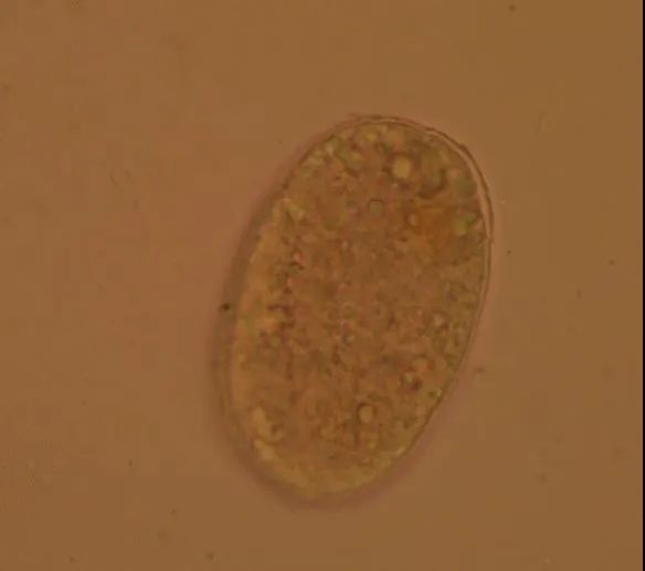 Obecność pasożytów może powodować wiele dolegliwości