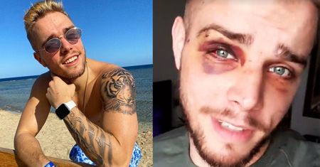 Blondino z "Hotelu Paradise" został BRUTALNIE POBITY I OKRADZIONY