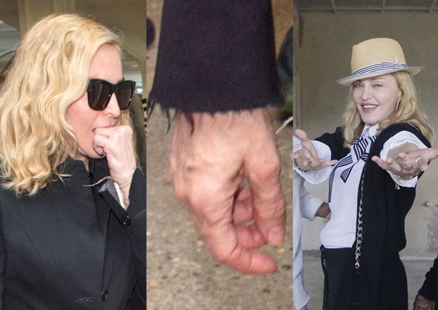 Madonna ma obsesję na punkcie dłoni! Wstrzykuje w nie kwas hialuronowy!