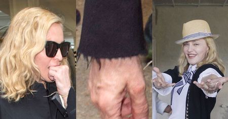 Madonna ma obsesję na punkcie dłoni! Wstrzykuje w nie kwas hialuronowy!
