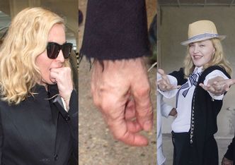 Madonna ma obsesję na punkcie dłoni! Wstrzykuje w nie kwas hialuronowy!