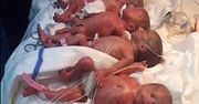 Mówili, że urodzi siedmioraczki. Prawda okazała się kompletnie inna