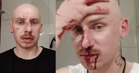 Jacek Szawioła z "Gogglebox" wyznaje: "ZOSTAŁEM POBITY na mojej własnej klatce"