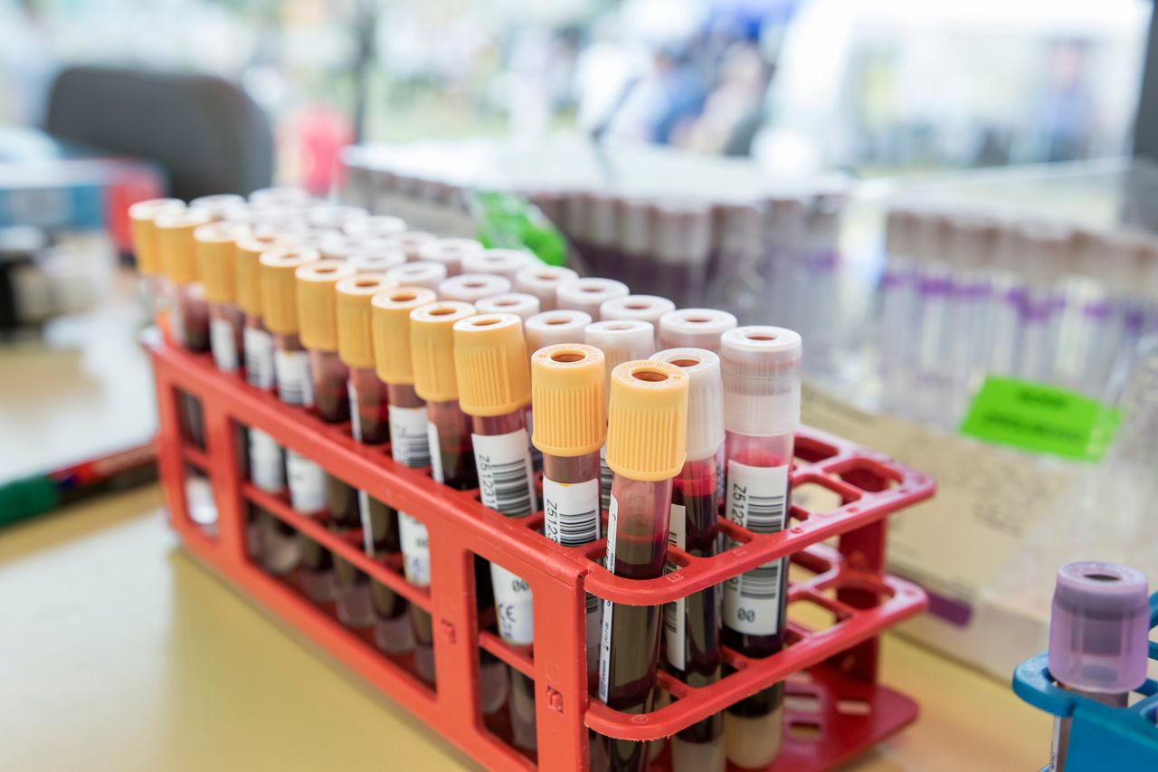 Kiedy zrobić test na HIV i co warto wiedzieć o tym badaniu
