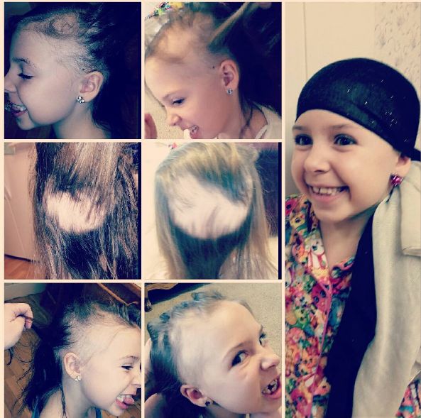 7-latka w miesiąc straciła wszystkie włosy. Mama znalazła rozwiązanie na pozbycie się jej kompleksów