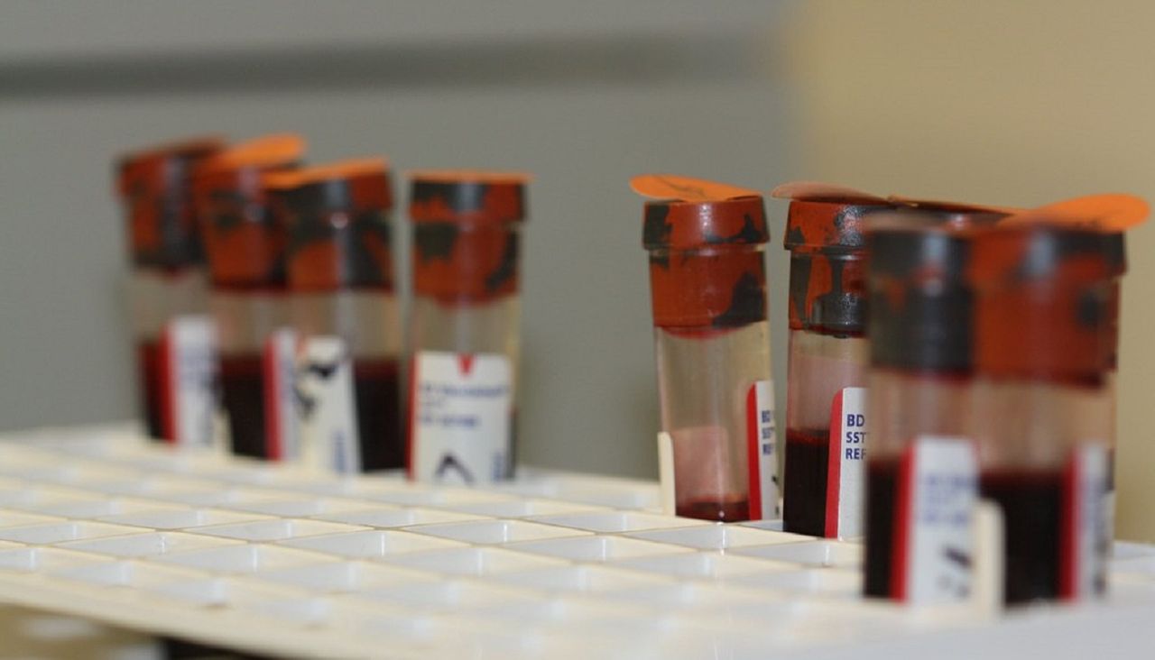 Naukowcy: testy krwi mogą wykryć nowotwór nawet cztery lata przed objawami