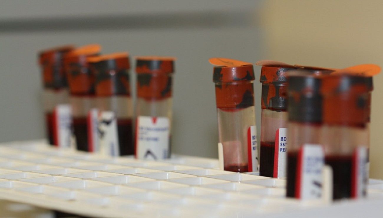 Naukowcy z USA opracowali test krwi. Mogą wykryć raka nawet 4 lata przed pojawieniem się objawów