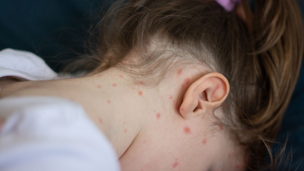 Odra coraz poważniejszym problemem za oceanem