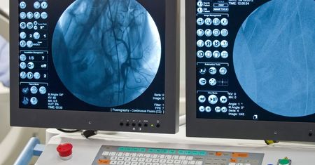 Angiografia - na czym polega, wskazania, przeciwwskazania, powikłania