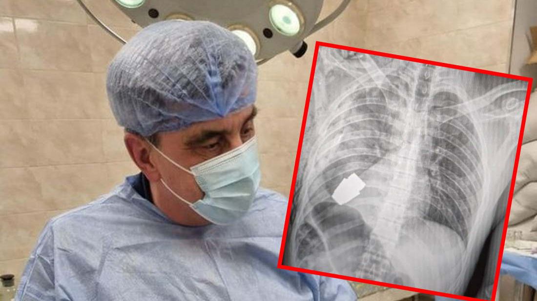 W ciele ukraińskiego żołnierza utknął niewybuch