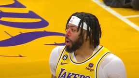 Gwiazdor Lakers dostał w twarz, pojawiła się krew. Mimo wszystko zagrał wielki mecz