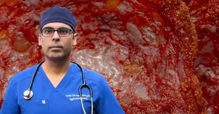 Gastrolog radzi przestać jeść takie mięso. Najgorsze dla wątroby