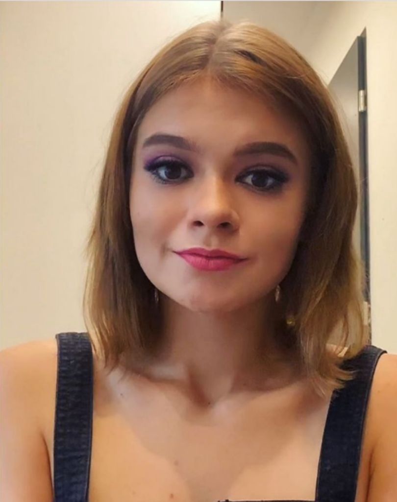 Julia Wróblewska powiększyła usta kwasem hialuronowym
