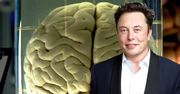 To nie science-fiction. Elon Musk rewolucjonizuje świat implantami mózgu