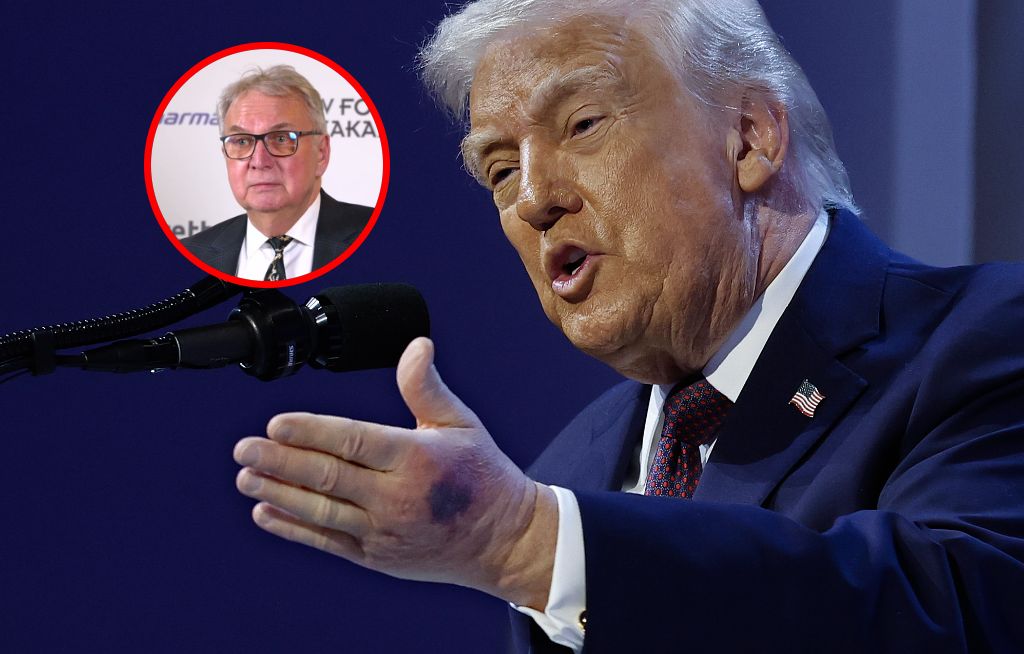 Siniaki, aspiryna i "rzadka krew". Zdrowie Donalda Trumpa znów tematem nr 1