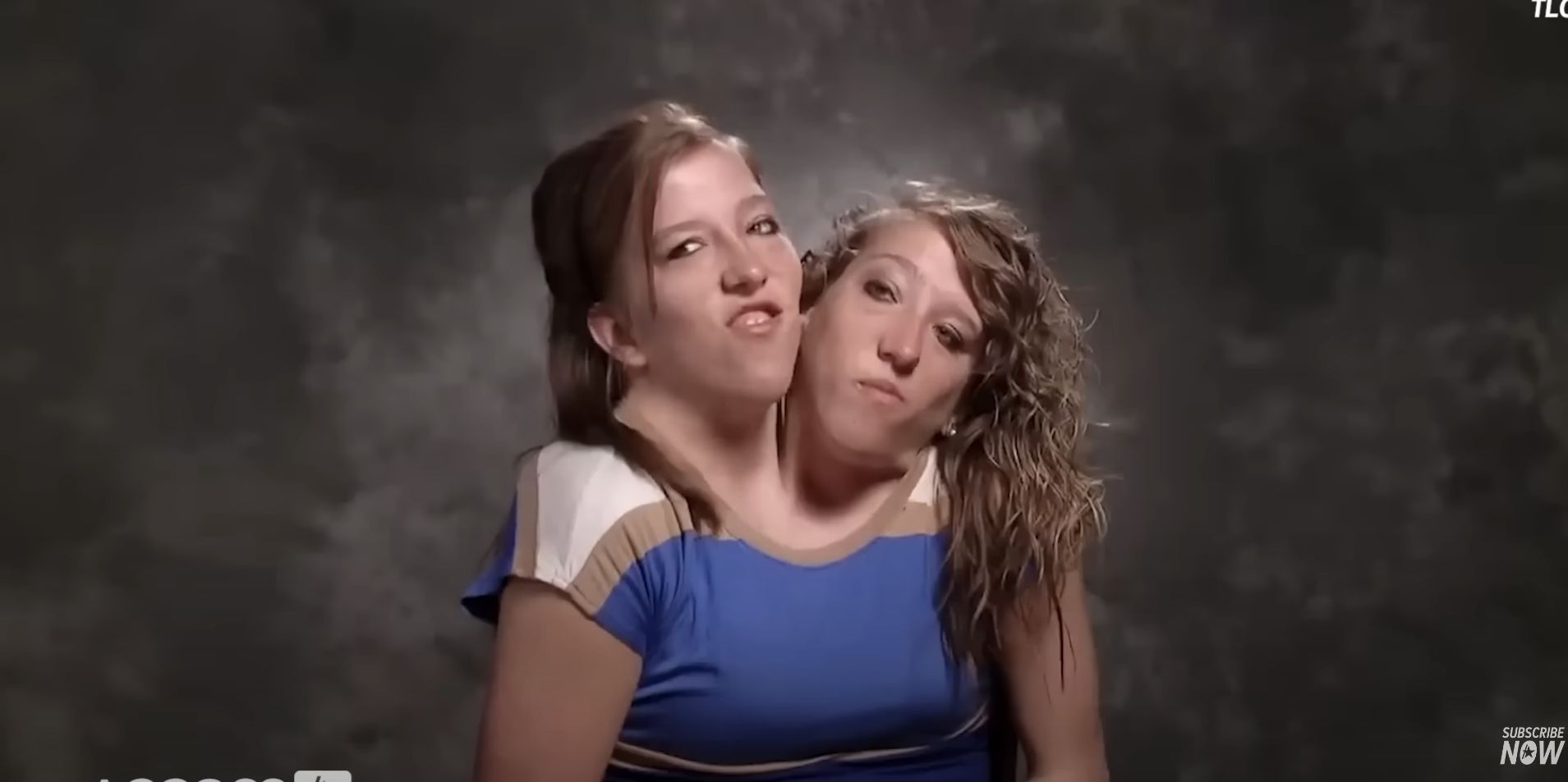 Abby i Brittany Hensel