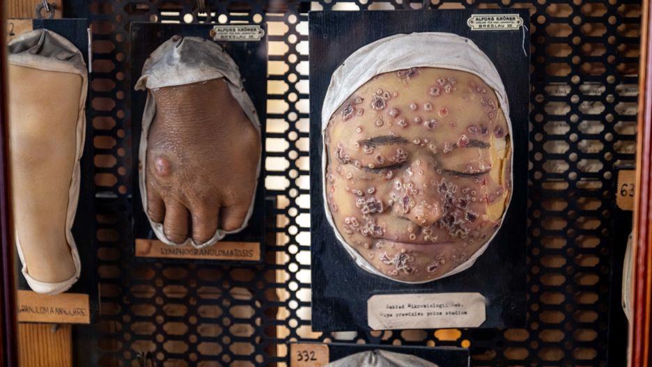 Eksponaty mogą wywoływać gęsią skórkę