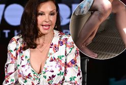 Ashley Judd ledwo uszła z życiem. Pokazała pokiereszowane nogi