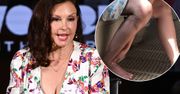 Ashley Judd ledwo uszła z życiem. Pokazała pokiereszowane nogi