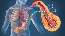 Objawy insulinooporności. Sygnały, których nie wolno lekceważyć