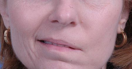 Dostali porażenia przez szczepionkę? Eksperci dementują i uspokajają