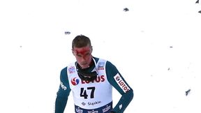 Skoki narciarskie. Puchar Świata Wisła 2019. Piotr Żyła z zakrwawioną twarzą. Pechowy upadek Polaka