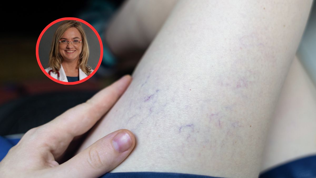 Coraz więcej Polaków zmaga się z chorobami wątroby