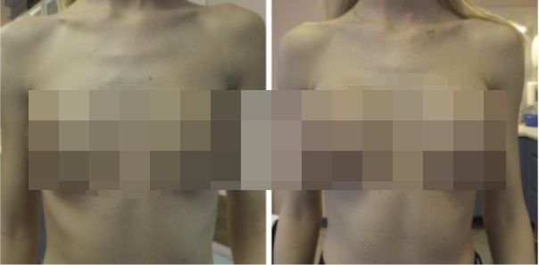 Zdjęcia przed i po operacji