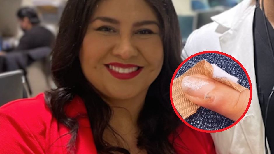 Manicure mógł wywołać raka