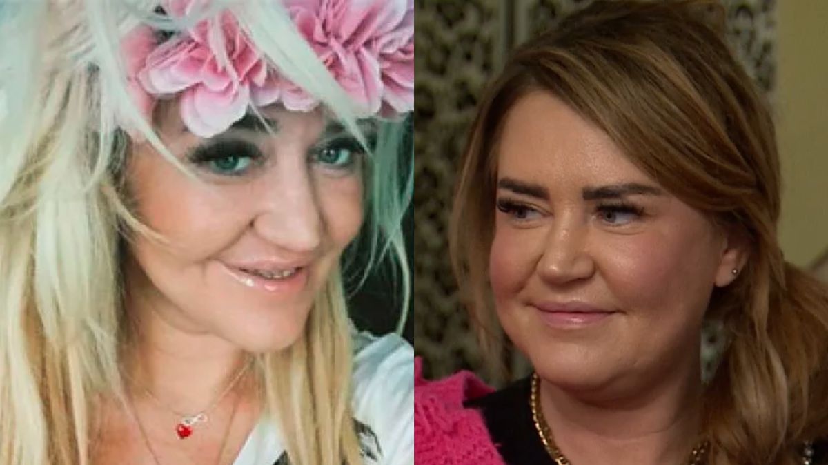 Agnieszka Kotońska jednak poprawiała urodę. Przyznała się w programie