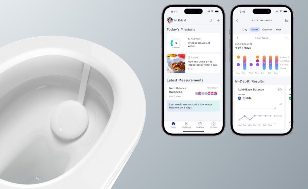 Withings U-Scan wygląd