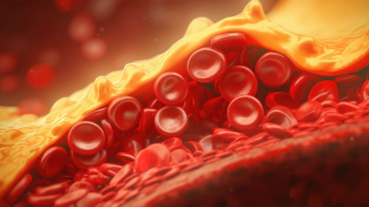 Atorvasterol stosuje się w celu obniżenia zwiększonego stężenia cholesterolu całkowitego, frakcji LDL cholesterolu, apolipoproteiny B i triglicerydów.