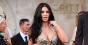 Kim Kardashian zdecydowała się na nietypowy zabieg. Nie są dozwolone w USA