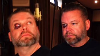 Znany producent muzyczny POBITY w barze: "6 szwów, 3 złamane zęby, opuchnięte oko i utrata pamięci" (WIDEO)