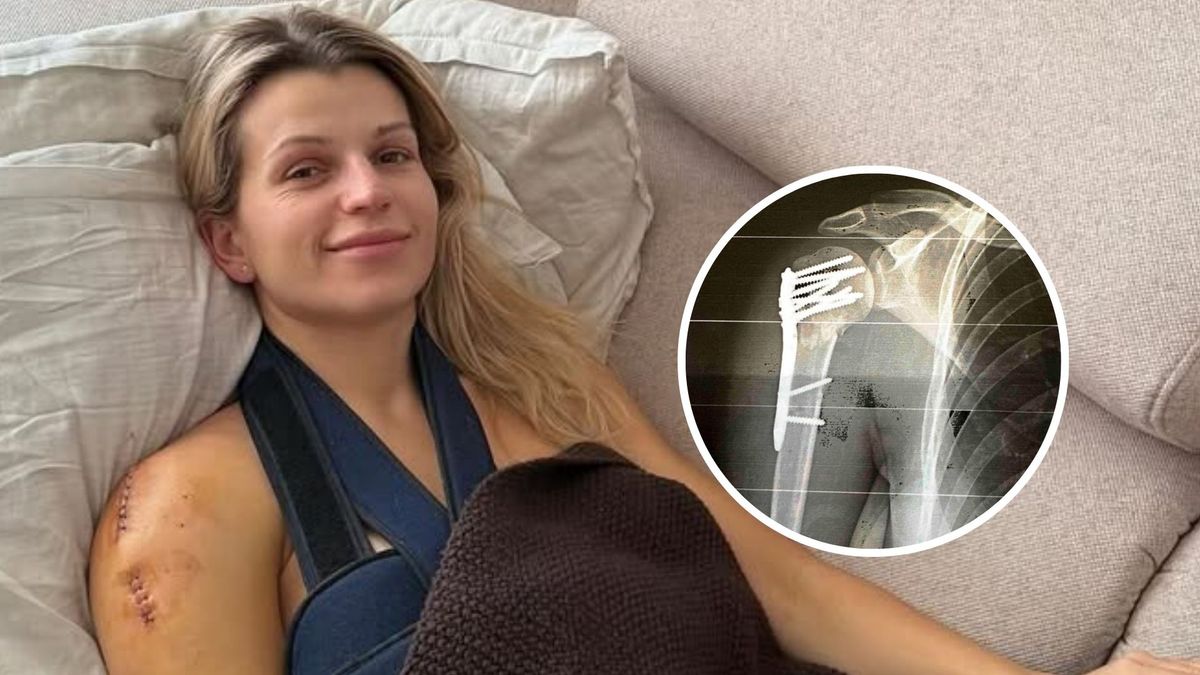 Aleksandra Rogowska-Lichnerowicz miała wypadek na stoku 