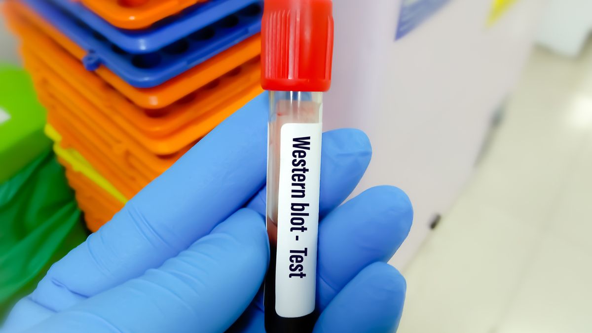 Test Western Blot wykorzystuje się m.in. do potwierdzenia diagnozy boreliozy