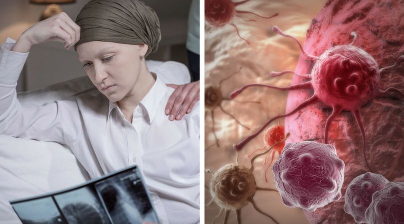 Alternatywne sposoby leczenia raka? Ekspert wyjaśnia i ostrzega