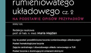 Obrazy kliniczne tocznia rumieniowatego układowego, cz. 2. Na podstawie opisów przypadków. W gabinecie lekarza specjalisty. Reumatologia