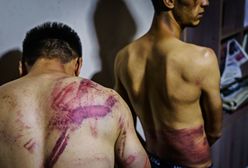 Horror w Afganistanie. Dziennikarze pokazali zdjęcia. Mówią o torturach