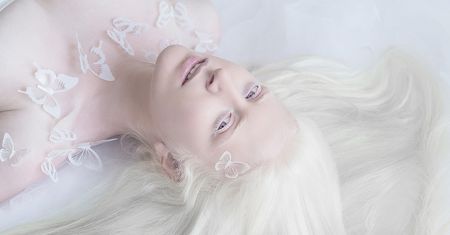Julia Taits ujęła piękno alabastrowej cery ludzi z albinizmem w baśniowym projekcie
