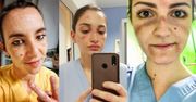 Lekarze i pielęgniarki po dyżurach. Te selfie pokazują twarze prawdziwych bohaterów