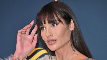 Karolina Gilon opowiada o operacji POMNIEJSZENIA PIERSI. "Miałam rozmiar H. Uzbieraliśmy w rodzinie pieniądze"