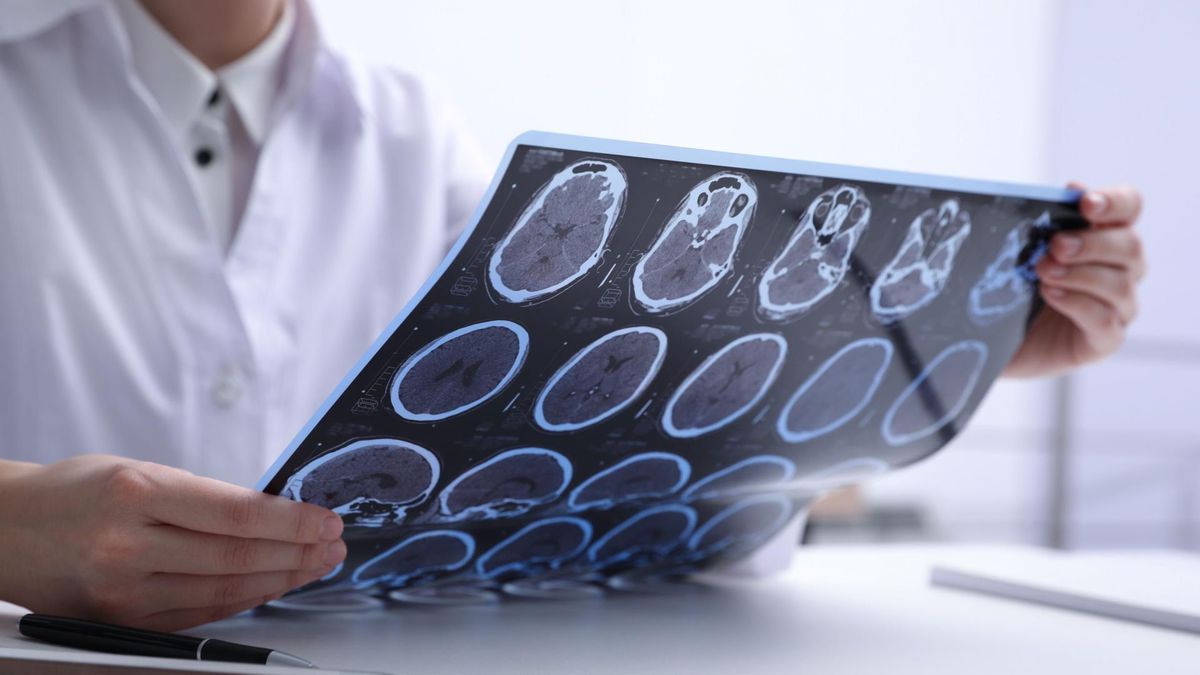 Nowe badania mogą przczynić się do rozwoju leczenia chorób neurologicznych