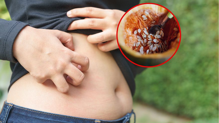 W walce z pasożytami pomogą zioła