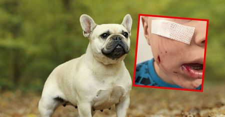 Brutalny atak psa na dziecko. Rodzice pilnie szukają właściciela
