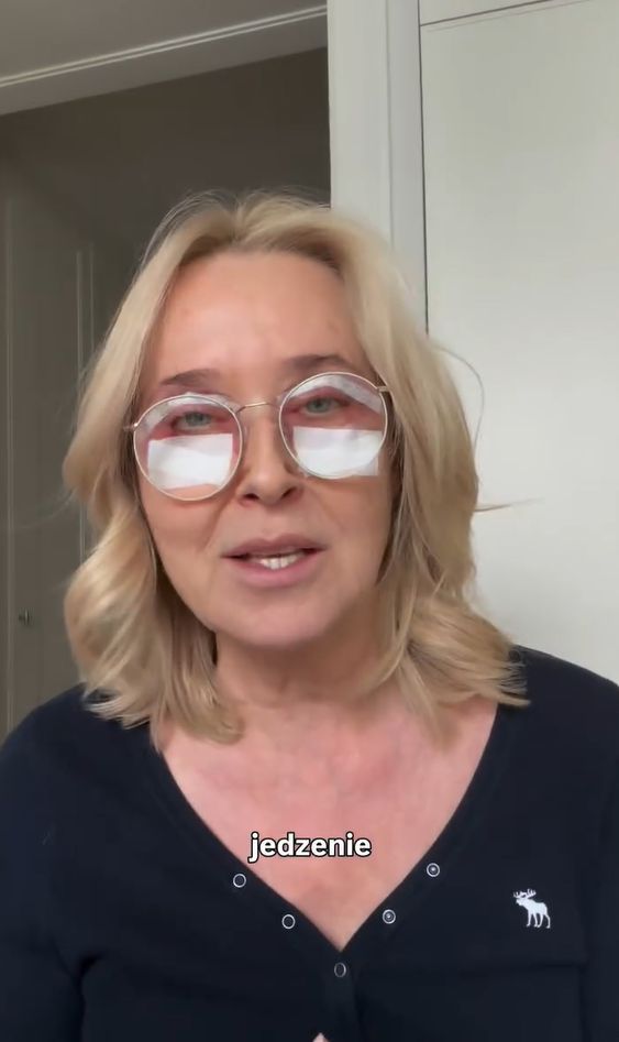 Agata Młynarska po zabiegu blefaroplastyki